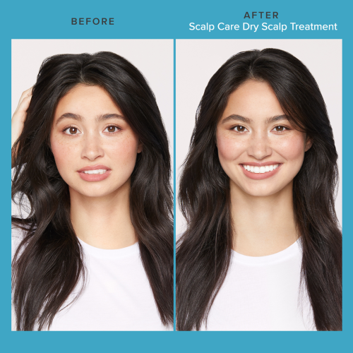SCALP CARE DRY Treatment 100 ml - Imagen 3